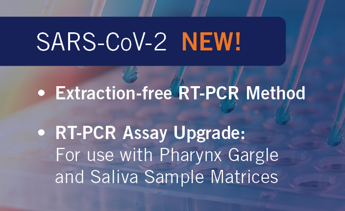 Eurofins Launches New Ultra-fast Extraction-free RT-PCR Method And ...